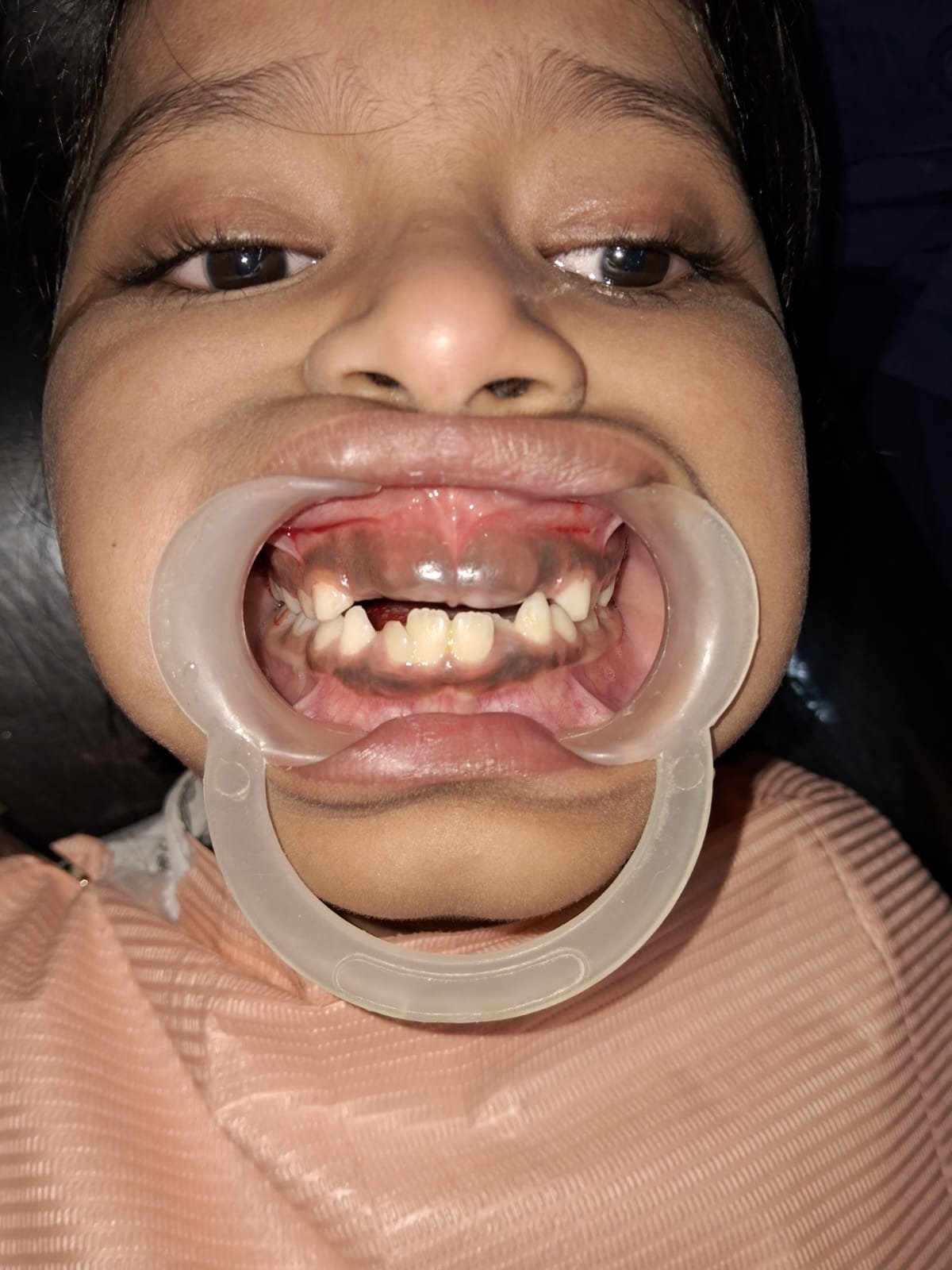 After dental treatment
